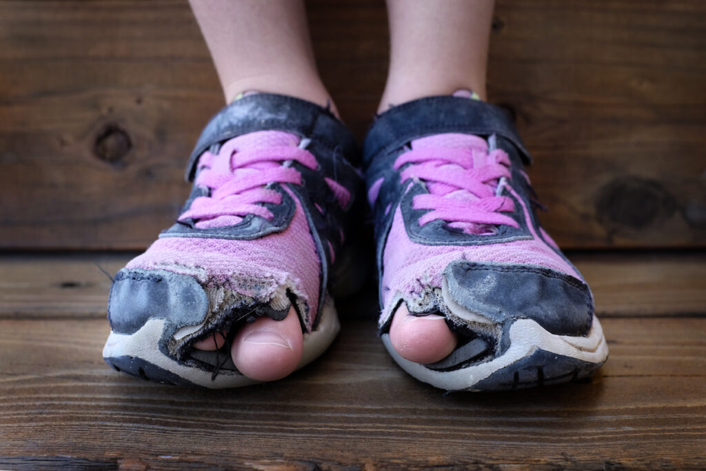 Child's sneakers with toes sticking out
